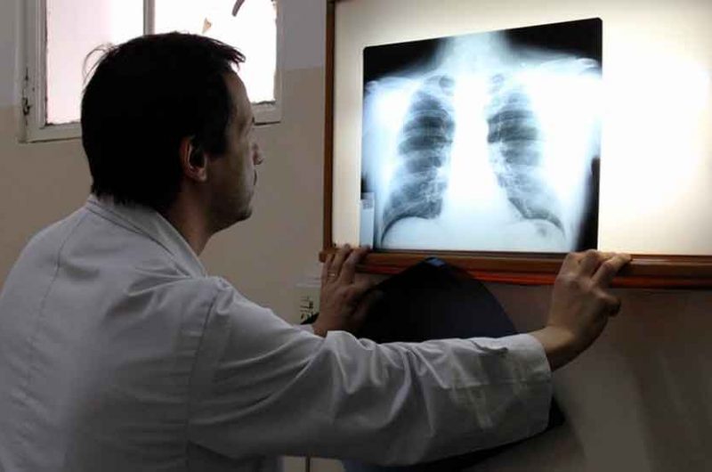 Día mundial de la Tuberculosis Día mundial de la Tuberculosis